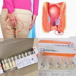 Kem bôi trĩ Posterisan Forte Nhật Bản 2g x 50 tuýp 11 kem boi tri posterisan forte nhat ban 2g x 50 tuyp ka