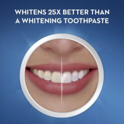 Miếng dán trắng răng Crest 3D Whitestrips Charcoal Mint 28 miếng (14 cặp)+ 1 tuýp serum 11 mieng dan trang rang crest 3d whitestrips charcoal mint 28 mieng 14 cap 1 tuyp serum ka