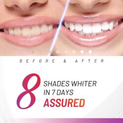 Bộ làm trắng răng bằng ánh sáng xanh White Glo Accelerator bật trắng 8 tone trong 7 ngày 10 bo lam trang rang bang anh sang xanh white glo accelerator bat trang 8 tone trong 7 ngay kc