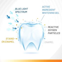 Bộ làm trắng răng bằng ánh sáng xanh White Glo Accelerator bật trắng 8 tone trong 7 ngày 12 bo lam trang rang bang anh sang xanh white glo accelerator bat trang 8 tone trong 7 ngay ke