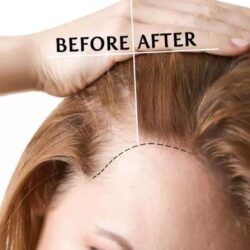 vien uong dep da toc mong puritans pride hair skin nails 90 caplets hair women