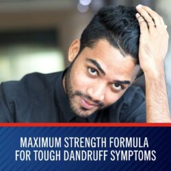 Dầu gội ngăn gàu Selsun Blue Medicated Maximum Strength 325ml 14 dau goi ngan gau selsun blue medicated maximum strength 325ml ke