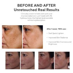 Set dưỡng sáng da, xóa thâm nám Murad Start Bright Here 15 set duong sang da xoa tham nam murad start bright here kf