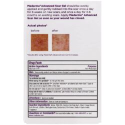 kem lien seo mederma advanced scar gel 50g kb