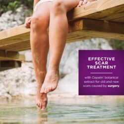 Kem liền sẹo Mederma Advanced Scar Gel 20g 15 kem lien seo mederma advanced scar gel 50g ke