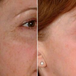 Serum dưỡng sáng da 20% Vitamin C The Perfect C 30ml 16 serum duong sang da 20 vitamin c the perfect c 30ml kg