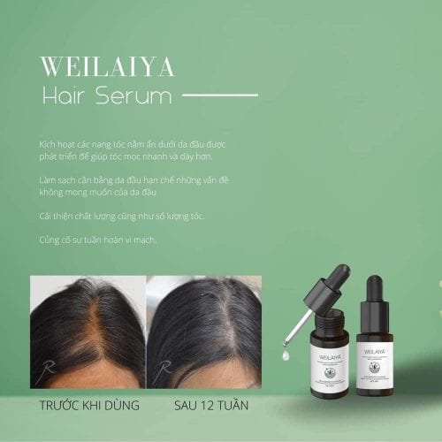 Serum mọc tóc Weilaiya With Ginger Polygonum 5ml x 8 lọ 29 serum moc toc weilaiya with ginger polygonum 5ml x 8 lo kc