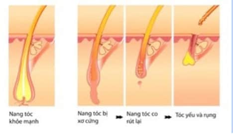 Serum mọc tóc Weilaiya With Ginger Polygonum 5ml x 8 lọ 30 serum moc toc weilaiya with ginger polygonum 5ml x 8 lo kd