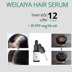 Serum mọc tóc Weilaiya With Ginger Polygonum 5ml x 8 lọ 20 serum moc toc weilaiya with ginger polygonum 5ml x 8 lo ke