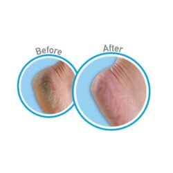 Kem giảm nứt gót chân O’Keeffe’s Healthy Feet Cream 76g 11 kem giam nut got chan okeeffes healthy feet cream 76g ke