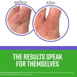 Kem dưỡng da tay O’Keeffe’s Working Hands Night Treatment 85g 10 kem duong da tay okeeffes working hands night treatment 85g kb