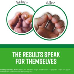 Kem dưỡng da tay O’Keeffe’s Working Hands Night Treatment 85g 9 kem duong da tay okeeffes working hands night treatment 85g kc