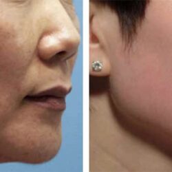 kem duong trang da chong lao hoa zo skin health retinol skin brightener 1 50ml ka