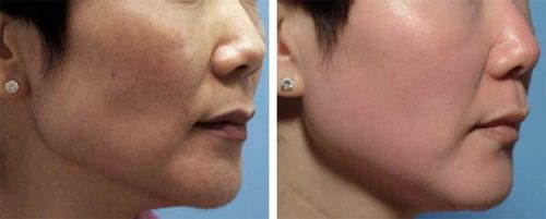 kem duong trang da chong lao hoa zo skin health retinol skin brightener 1 50ml ka