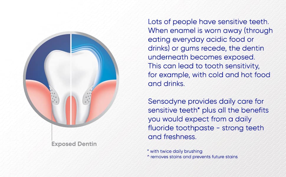 Lốc 4 kem đánh răng Sensodyne Advanced Whitening 184g x4 6 loc 4 kem danh rang sensodyne advanced whitening 184g x4 260126 kf