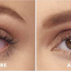 Nhỏ mắt Lumify giảm đau mắt đỏ Lumify Redness Reliever Eye Drops 15ml (7.5ml x2 chai) 13 nho mat lumify giam dau mat do lumify redness reliever eye drops 15ml 7 5ml x2 chai ka