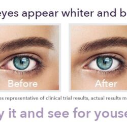 Nhỏ mắt Lumify giảm đau mắt đỏ Lumify Redness Reliever Eye Drops 15ml (7.5ml x2 chai) 12 nho mat lumify giam dau mat do lumify redness reliever eye drops 15ml 7 5ml x2 chai kg