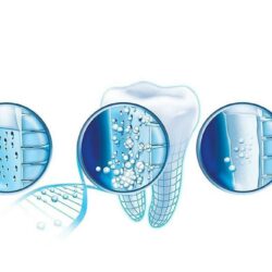 Kem đánh răng Sensodyne Repair & Protect 96.4g x5 9 kem danh rang sensodyne repair protect 96 4g x5 kc