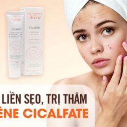 kem lien seo phuc hoi da avene cicalfate restorative skin cream 100ml kb