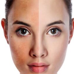 Bộ sáng da, mờ nám, chống nắng Martiderm Pigment Zero DSP-Cream SPF50 40ml + Micellar Gel 15ml + Exfoliante Scrub 15ml 9 skin beauty women nam tan nhang trang da