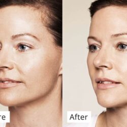 Tinh chất chống lão hóa, làm sáng da Martiderm Black Diamond Skin Complex Advanced 2ml x 30 ống 11 women skin beauty chong lao hoa