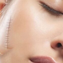 kem boi lam mo seo polysporin heal fast formula original cream 15g kc