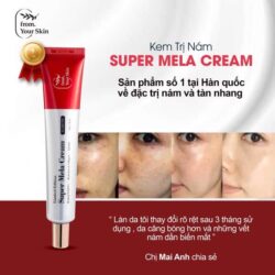 kem sieu xoa nam from your skin super mela cream 50g kc