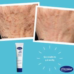 kem duong sang da dermisa skin fade cream antioxidant vitamin c 50g kd