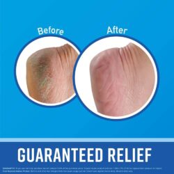 Kem giảm nứt gót chân O’Keeffe’s Healthy Feet 85g 7 kem giam nut got chan okeeffes healthy feet 85g knb
