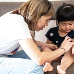 kem boi muoi dot after bite sensitive 20g x3 ka