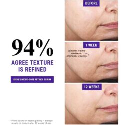 tinh chat tai tao da kiehls retinol skin renewing daily micro dose serum 50ml ke