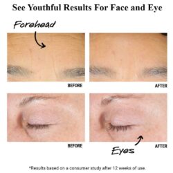 tinh chat tai tao da kiehls retinol skin renewing daily micro dose serum 50ml kf