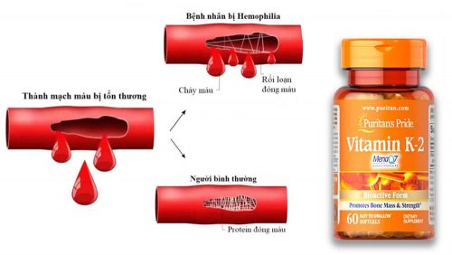 Viên uống bổ sung Vitamin K2 Puritan’s Pride Vitamin K2 50mcg 60 Softgels 8 vien uong bo sung vitamin k2 puritans pride vitamin k2 50mcg 60 softgels kd