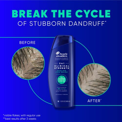 Dầu gội xả sạch gàu Head & Shoulders Clinical Strength 2in1 Cooling Itch Relief 400ml (Giảm ngứa) 7 dau goi xa sach gau head shoulders clinical strength 2in1 400ml giam ngua chuyen sau 070725 kd