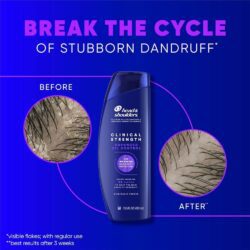 Dầu gội sạch gàu Head & Shoulders Clinical Strength 400ml (Kiểm soát dầu nhờn) 9 dau goi sach gau head shoulders clinical strength 400ml kiem soat dau nhon 2 080425 kc