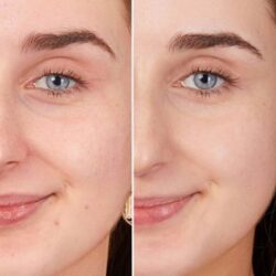 serum trang da obagi clinical vitamin c arbutin brightening serum 30ml kc