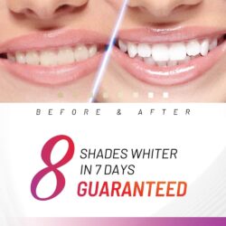 Bộ làm trắng răng White Glo Teeth Whitening Kit Plus Blue Light (dùng pin) 17 bo lam trang rang white glo teeth whitening kit plus blue light uc kg