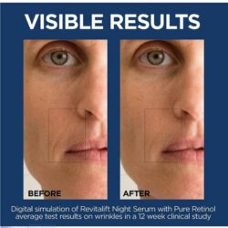 Serum chống lão hóa L’Oreal Revitalift Derm Intensives Night Serum With Pure Retinol 30ml 11 serum chong lao hoa loreal revitalift derm intensives night serum with pure retinol 30ml kb