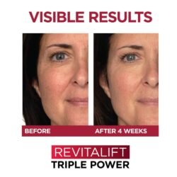 Serum chống lão hóa L’Oreal Revitalift Triple Power Anti-Aging Serum 30ml 17 serum chong lao hoa loreal revitalift triple power anti aging serum 30ml kh