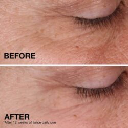 Kem phục hồi nếp nhăn Neutrogena Rapid Wrinkle Repair Retinol Regenerating Cream 14g 10 kem phuc hoi nep nhan neutrogena rapid wrinkle repair retinol regenerating cream 14g kb