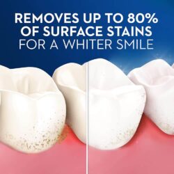 Bàn chải đánh răng Oral-B 3D White Soft 17 ban chai danh rang oral b 3d white soft kg