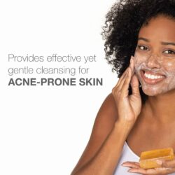 Xà bông cục rửa mặt cho da mụn Neutrogena The Transparent Facial Bar For Acne-Prone Skin 99g 11 xa bong cuc rua mat cho da mun neutrogena the transparent facial bar for acne prone skin 99g 080524 ke