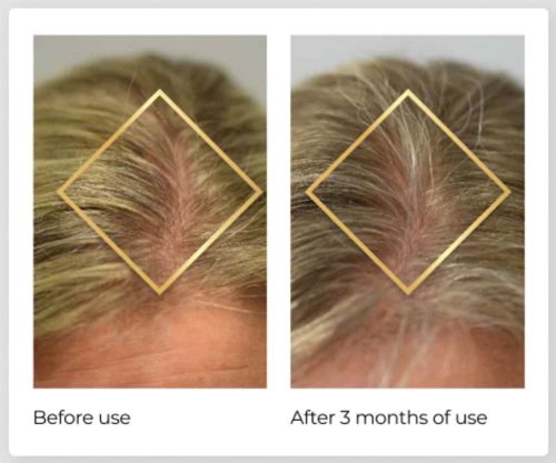 Viên uống hỗ trợ mọc tóc Nature’s Bounty Hair Growth 90 Capsules 9 vien uong ho tro moc toc natures bounty hair growth 90 capsules 231124 ka