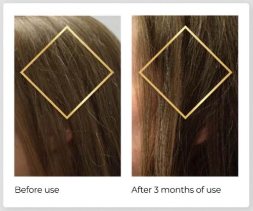 Viên uống hỗ trợ mọc tóc Nature’s Bounty Hair Growth 90 Capsules 11 vien uong ho tro moc toc natures bounty hair growth 90 capsules 231124 kc