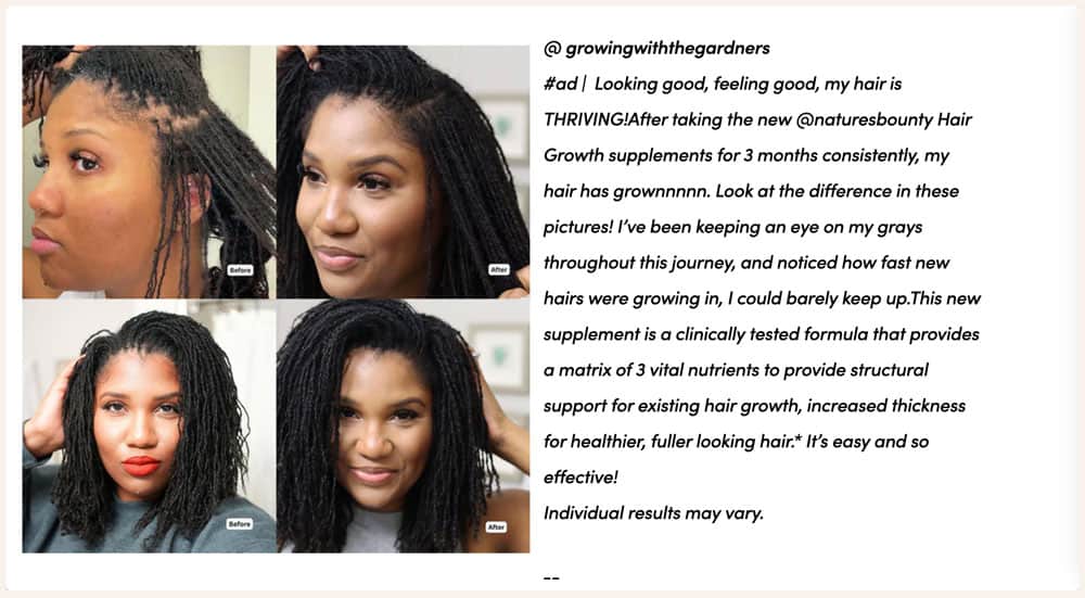 Viên uống hỗ trợ mọc tóc Nature’s Bounty Hair Growth 90 Capsules 15 vien uong ho tro moc toc natures bounty hair growth 90 capsules 231124 kg