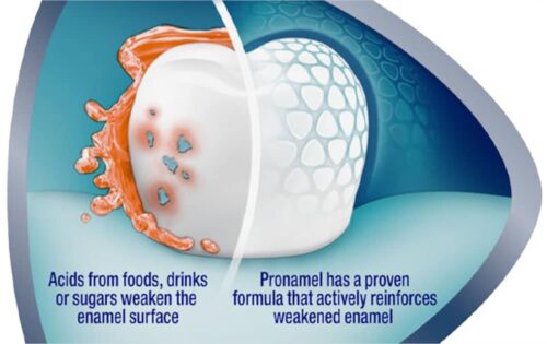 Kem đánh răng Sensodyne Pronamel Active Shield Whitening Cool Mint 96.4g 9 kem danh rang sensodyne pronamel active shield whitening cool mint 964g 060525 ke