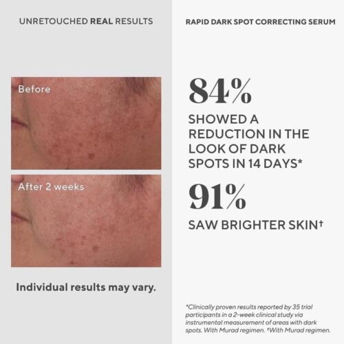 Serum giảm đốm nâu và nám Murad Environmental Shield Rapid Dark Spot Correcting Serum 30ml 6 serum giam dom nau va nam murad environmental shield rapid dark spot correcting serum 30ml 200825 kd