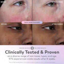 serum 5in1 duong am sang da giam nep nhan olay super serum 50ml 210126 ke