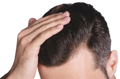 Dầu gội ngăn gàu Nizoral Anti-Dandruff Shampoo 400mL 8 dau goi tri gau nizoral anti dandruff shampoo 400 ml 040426 ka